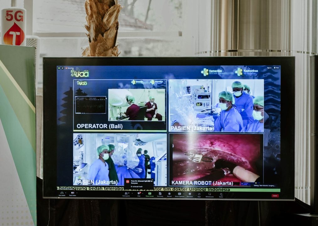 Telkomsel Berhasil Lakukan Robotic Telesurgery dengan Jaringan 5G, Jakarta-Bali! 2 Telkomsel Robotic Telesurgery 5G