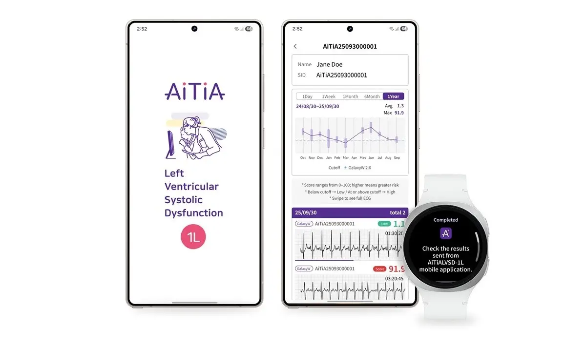 Samsung Bakal Hadirkan Teknologi LVSD Pertama di Smartwatch, Apa Itu?